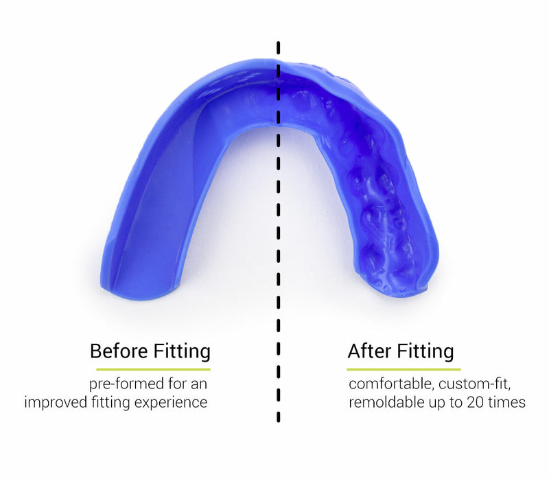 SISU 3D Custom Fit Mouthguard